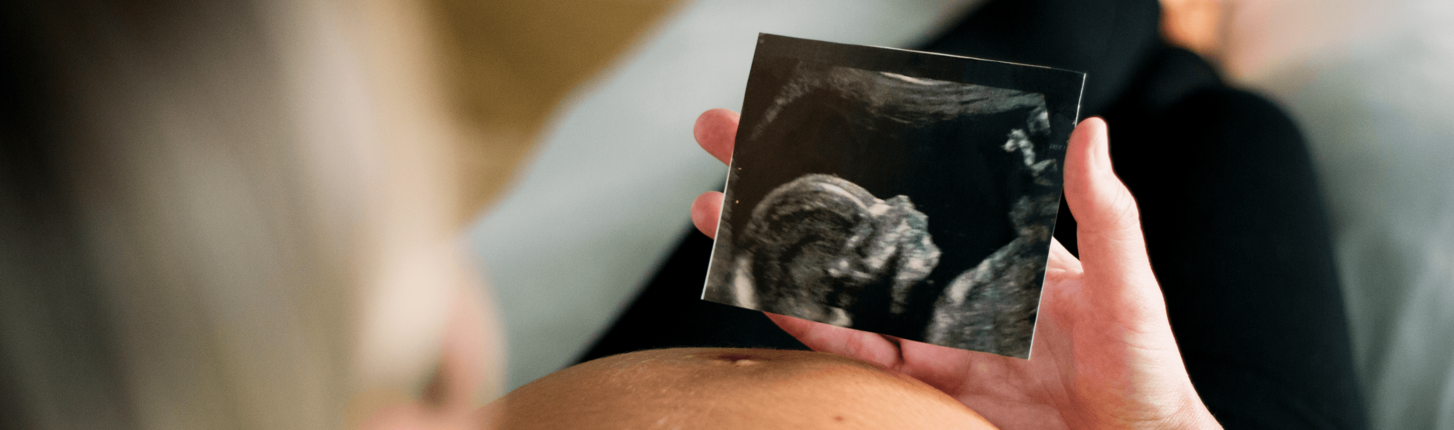 Newborn Stem Cell Banking: Benefits, Costs & Payment Plans in UAE